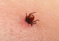 Encefalite da zecche, definito il calendario delle vaccinazioni a Paluzza, Ampezzo e Ovaro