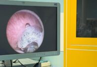 All’Ospedale di Tolmezzo una nuova tecnica laser per la prostata