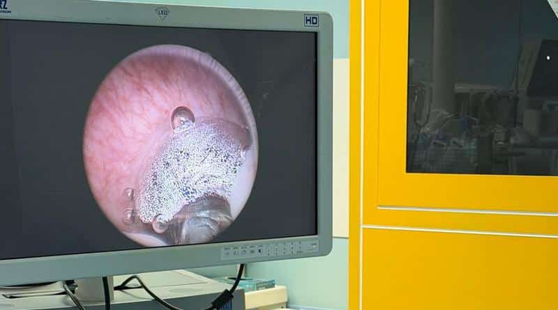 All’Ospedale di Tolmezzo una nuova tecnica laser per la prostata